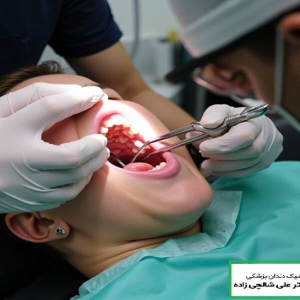 20250723_232043_1101414496 تصویر جراحی دندان