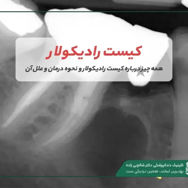 IMG_20250812_201242_001 (2) (58) رادیکولار