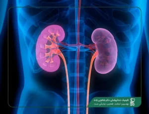 ارتباط پوسیدگی دندان و عفونت لثه با بیماری کلیوی