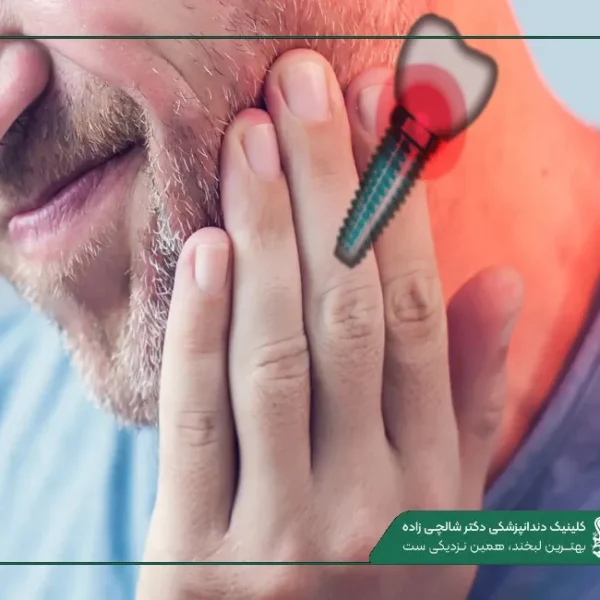 New Project (9) عوارض ایمپلنت دندان