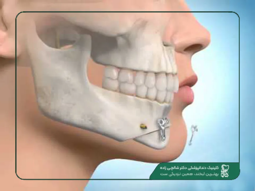 خدمات دندانپزشکی