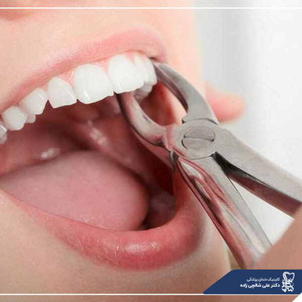 جراحی دندان هزینه جراحی دندان