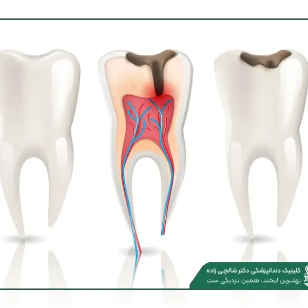 New Project هزینه دندانپزشکی در قیطریه