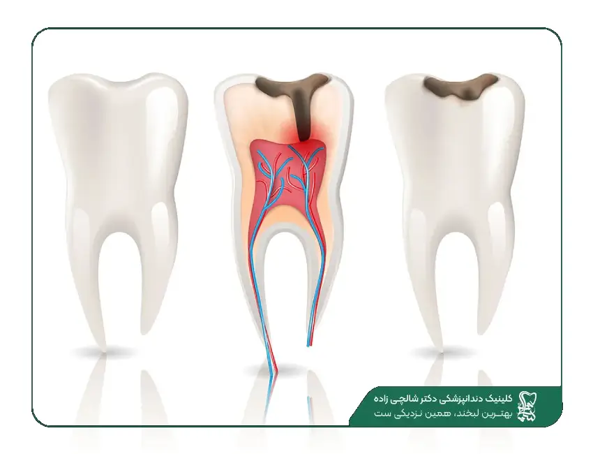 هزینه دندانپزشکی در قیطریه