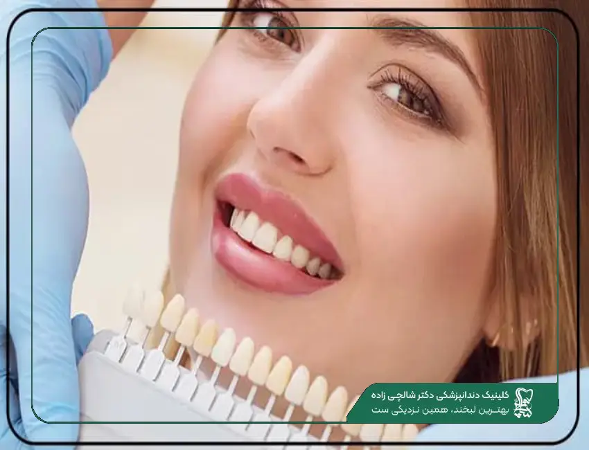 هزینه لمینت دندان