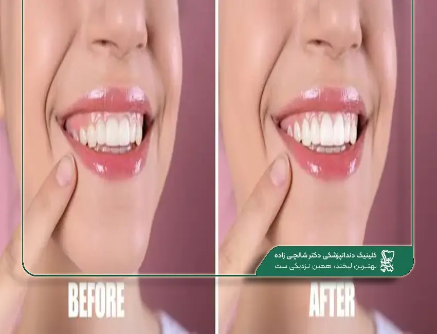 جراحی لثه در قیطریه