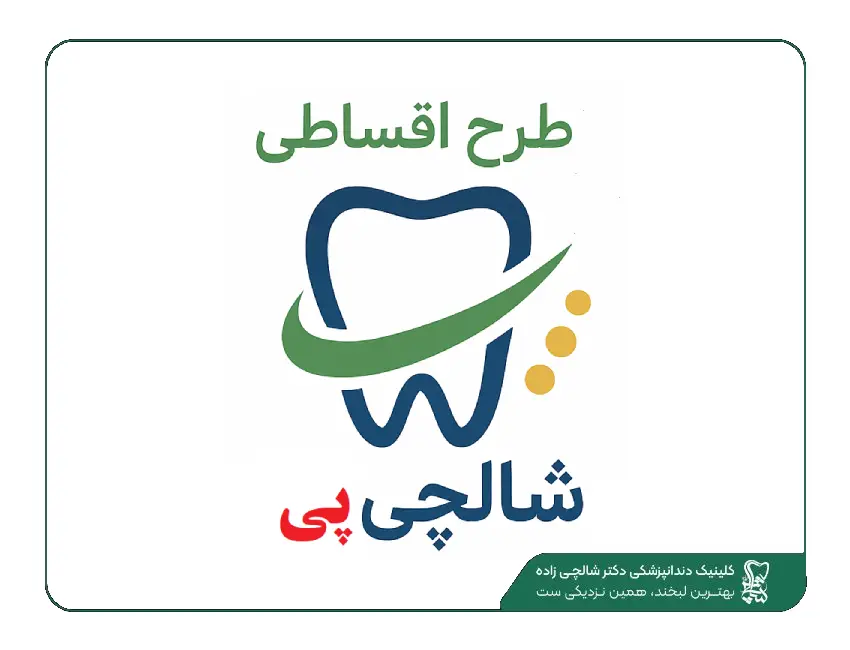 ایمپلنت قسطی در قیطریه
