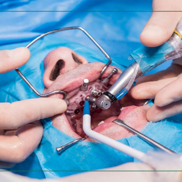 Ba Pi 8823 Bset Doctor Gheytariye بهترین دندانپزشکان قیطریه