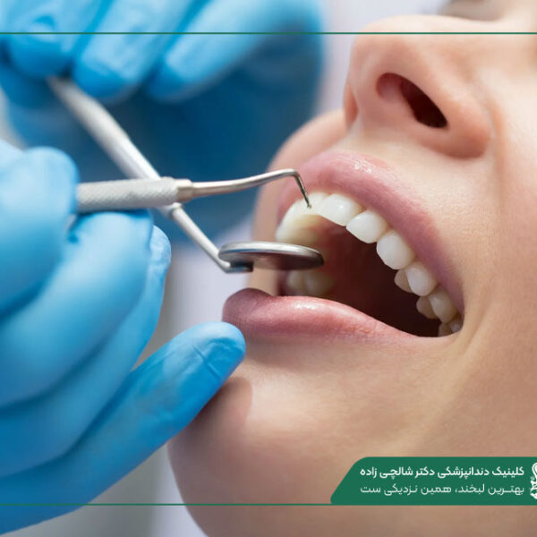 Ba Pi 9471 Dental Laminate In Martyrs' Square لمینت دندان میدان شهدا